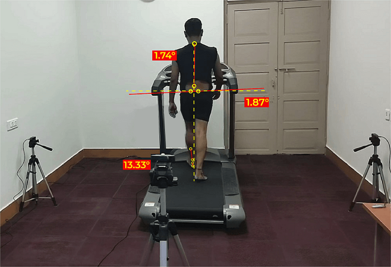 Rehabilitation Program