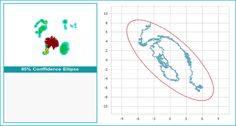 Center of poressure(COP) example