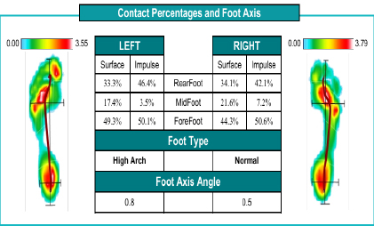 Gait Analysis Example