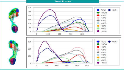Gait Analysis Example